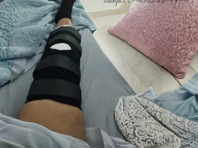 especialista en artroscopia rodilla julian ruiz